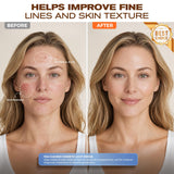 Avvnee perfil lateral ajustado para ilustrar ajuste ergonómico y manos libres