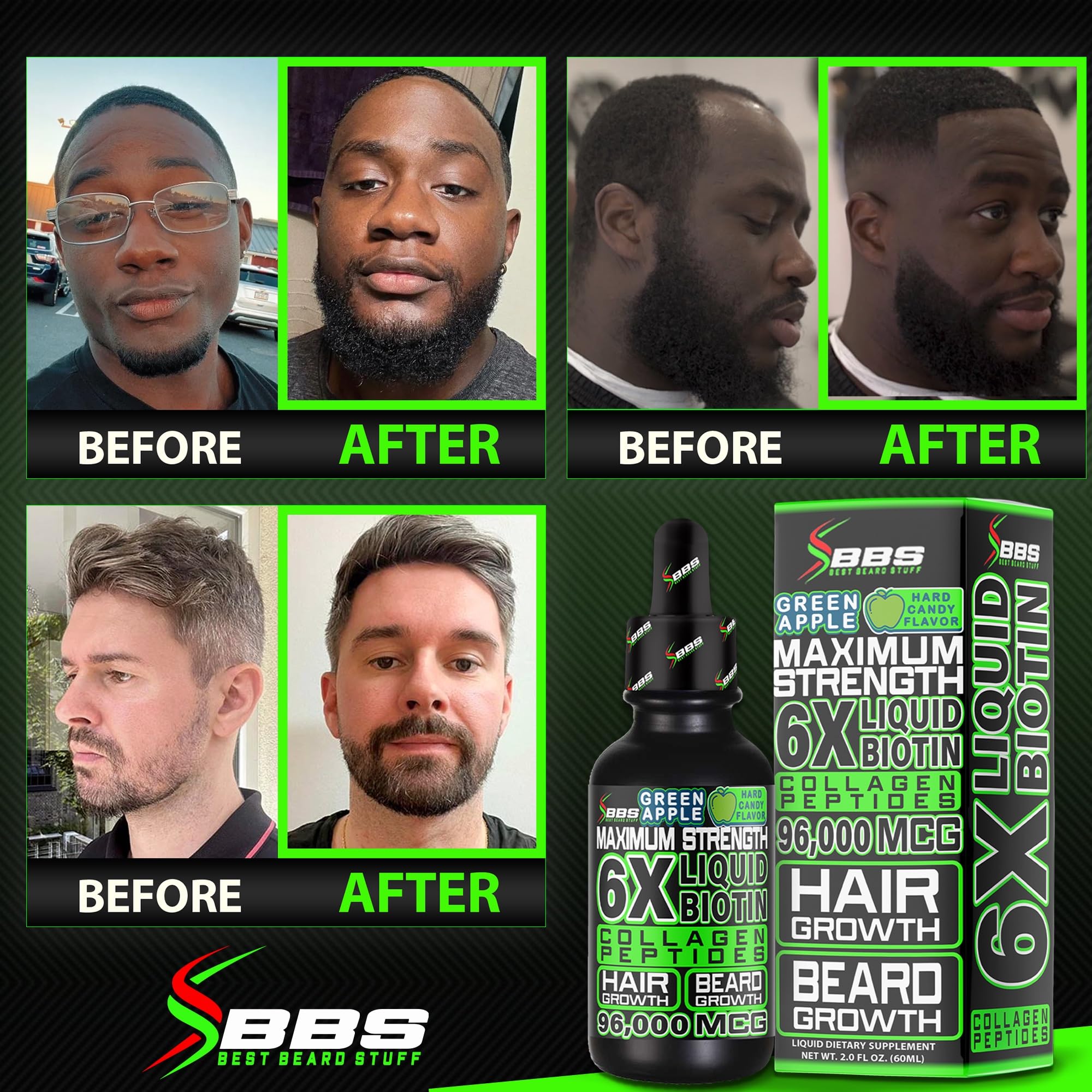 BBS aplicación sobre barba con gotero, beneficio de uso directo y cómodo