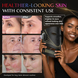 Blanight ambientada en baño para integrar terapia en rutina diaria