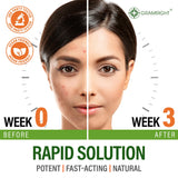 GRAMRIGHT ingredientes Perfect Skin combinados para soporte cutáneo
