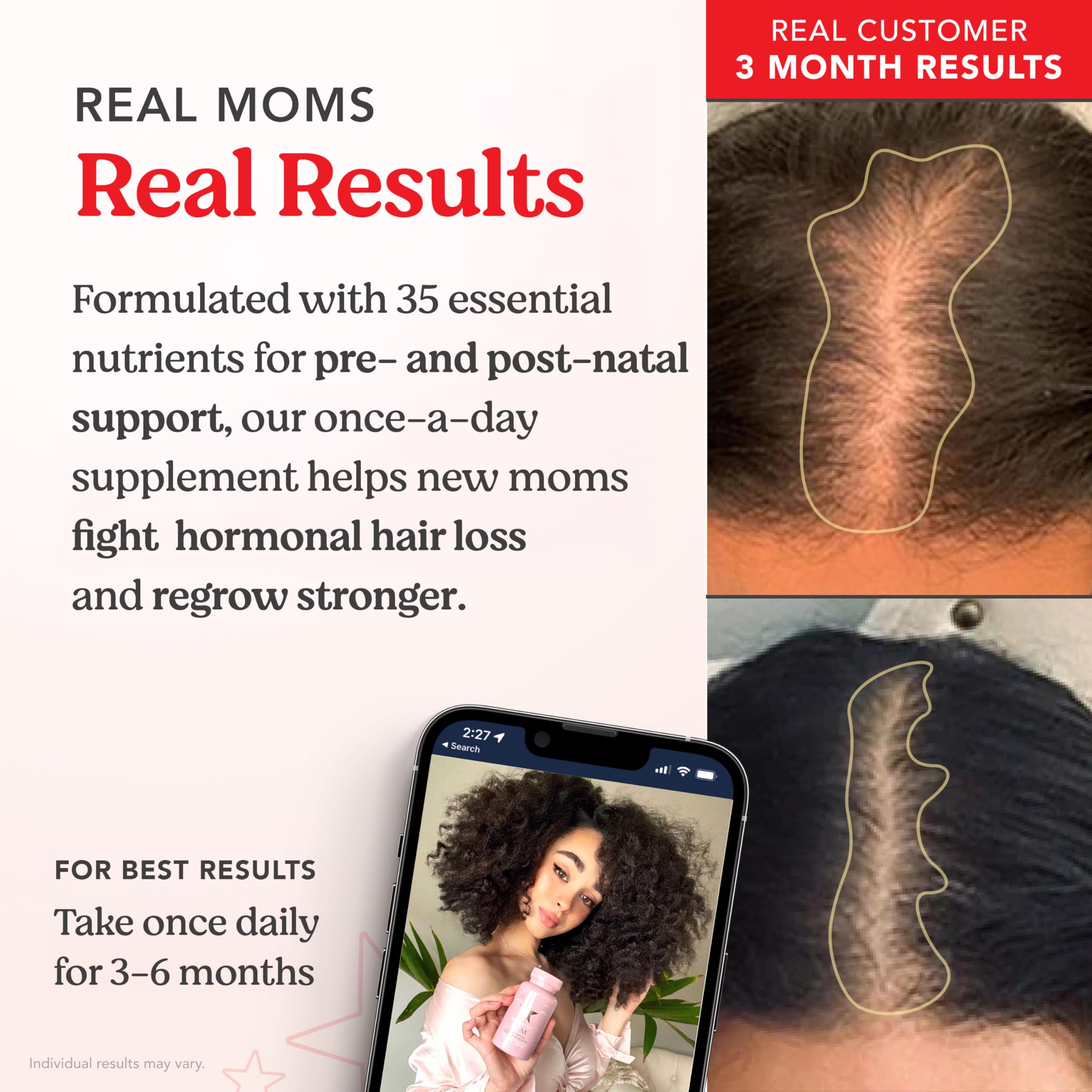 HAIRtamin MOM junto a desayuno para ilustrar uso diario y mejor absorción
