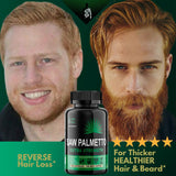 Helix Heal bayas de saw palmetto y extracto como origen natural
