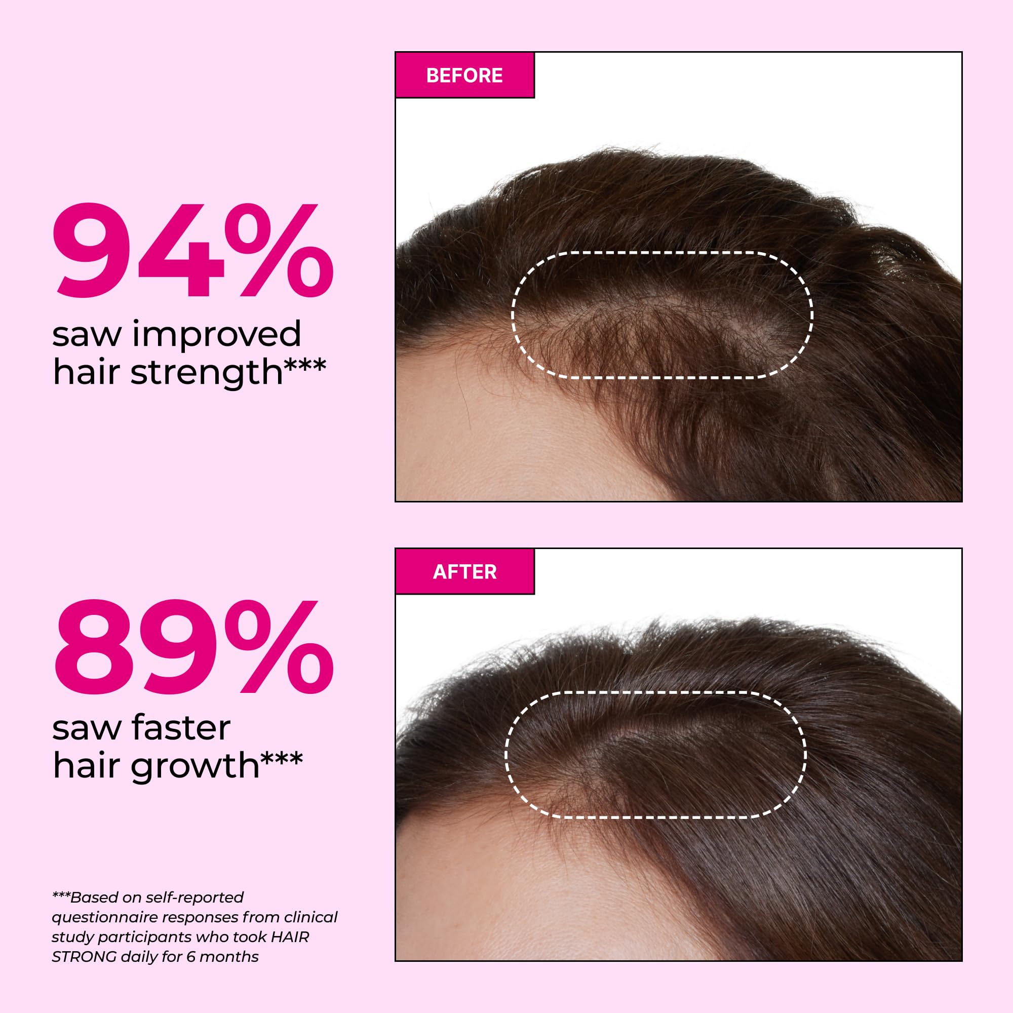 Primer plano gomita HUM Hair Strong texturada, muestra aspecto apetecible