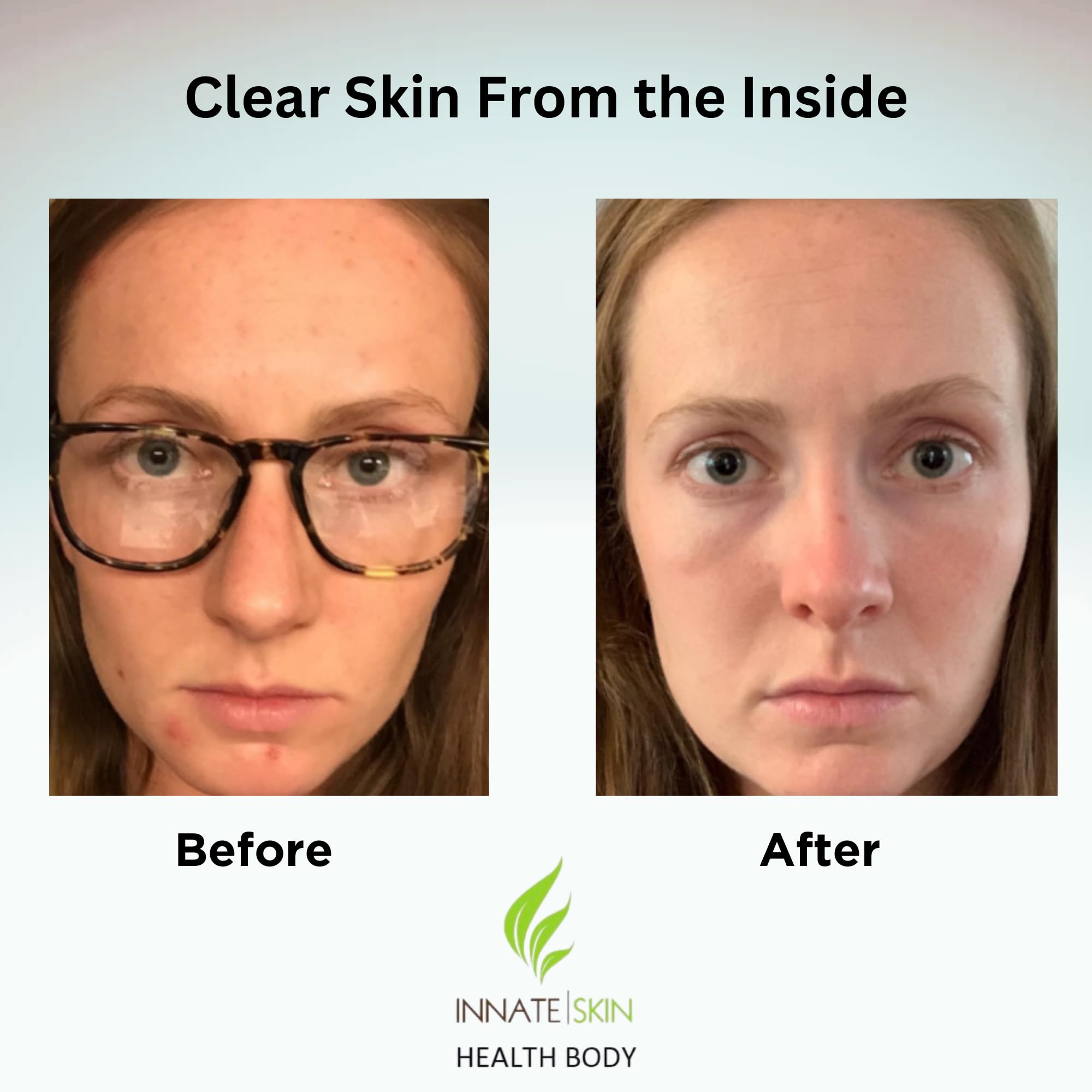 Innate Skin cápsulas textura cercana mostrando calidad y pureza