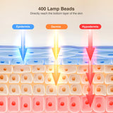 INTEO detalle de los 400 LEDs para amplia cobertura facial
