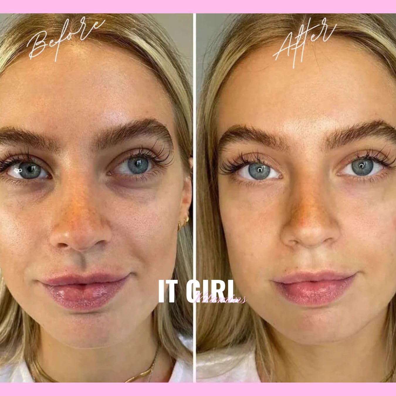 It Girl Vitamins etiqueta de ingredientes destacando componentes para la piel