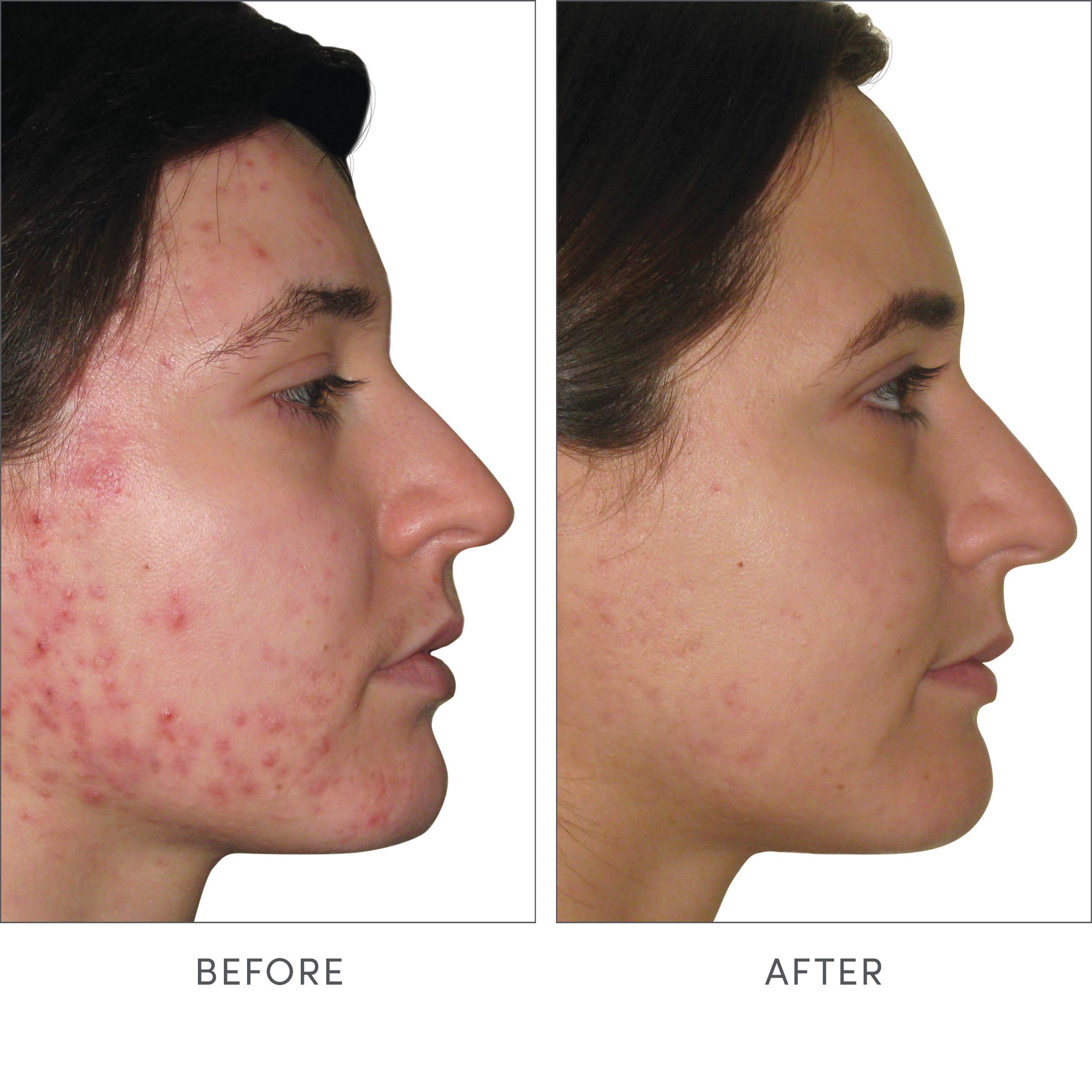jane iredale persona sujetando cápsula, evidencia de toma diaria