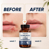Nuvary ingredientes con coco y lisina representados como ingredientes clave