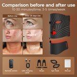 ONLUKY dispositivo para cuello separado, tratamiento combinado cuello y rostro