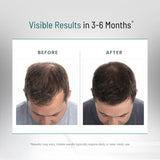 PEAK VITALS etiqueta nutricional visible que muestra transparencia y dosis