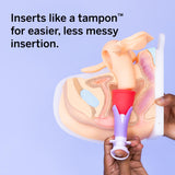 Pixie Cup aplicador en mano demostrando inserción fácil y beneficio ergonómico