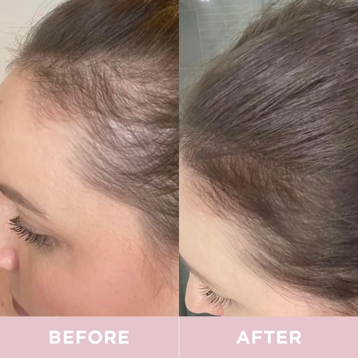 Revive Collagen botella junto a una regla para comparar tamaño y porciones