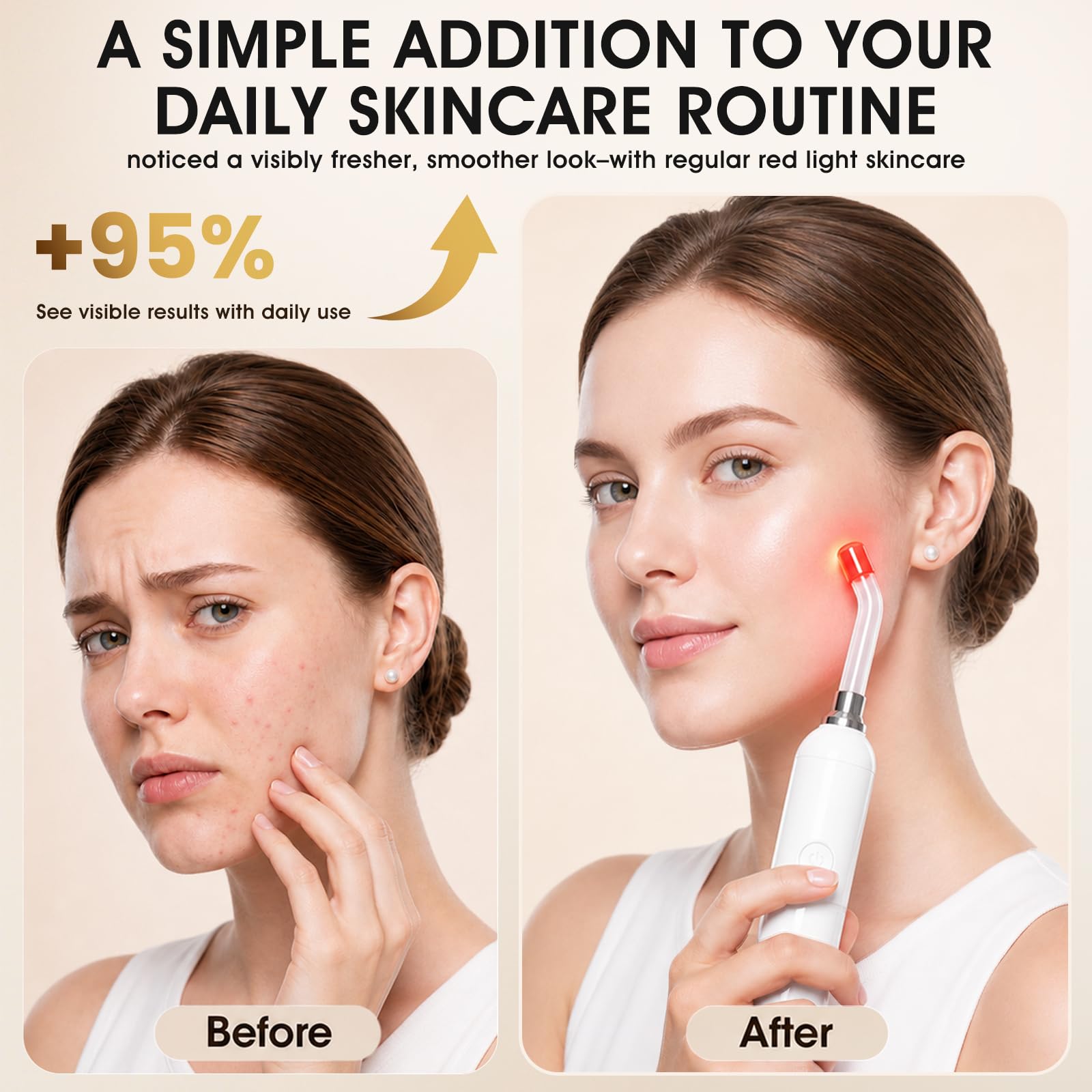 SplashGlow punta flexible en detalle para cavidades y labios