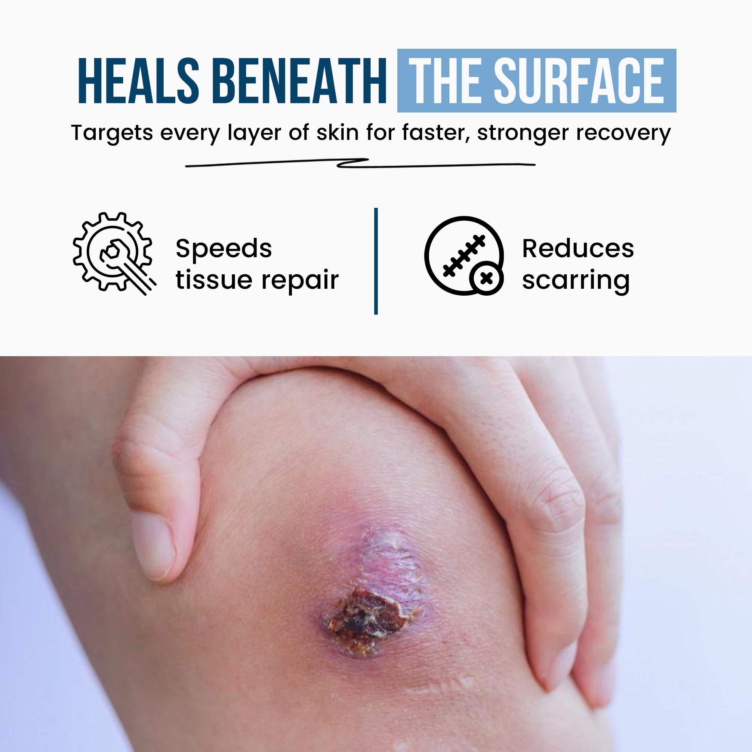 WOUND CAREPLUS producto sobre mesa clínica, profesional y seguro