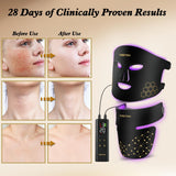 YOEYOU máscara usada en cuello para tratamiento combinado rostro-cuello